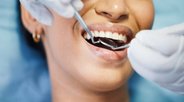 Best Emergency Cosmetic Dentistry (e.g., broken veneers) in Key Biscayne, FL
