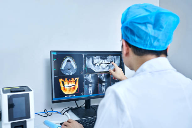 Best Emergency Wisdom Tooth Extraction in Key Biscayne, FL